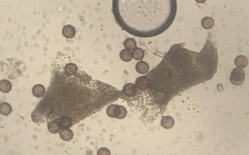 Physarum auriscalpium?